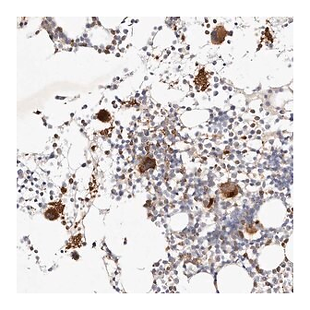 Merck Anti-MTMR11 antibody produced in rabbit