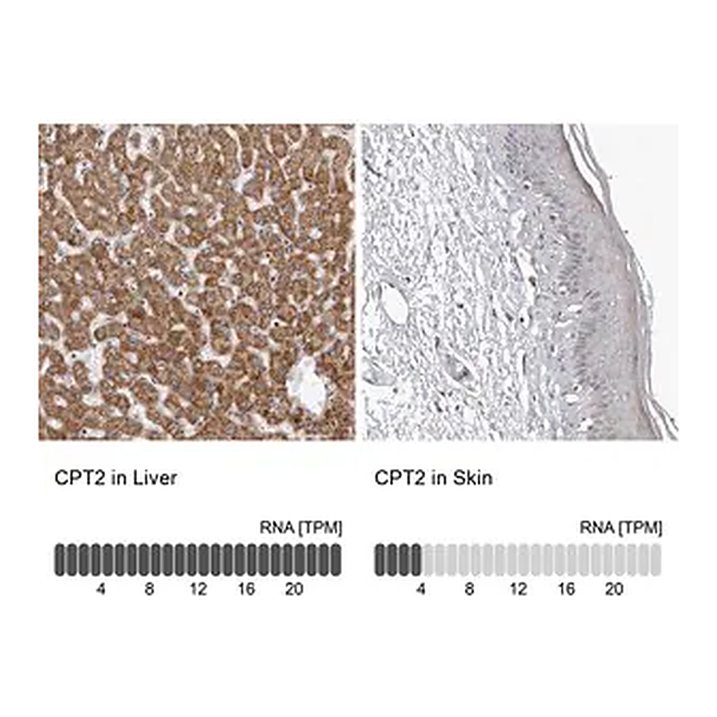 Merck Anti-CPT2 antibody produced in rabbit