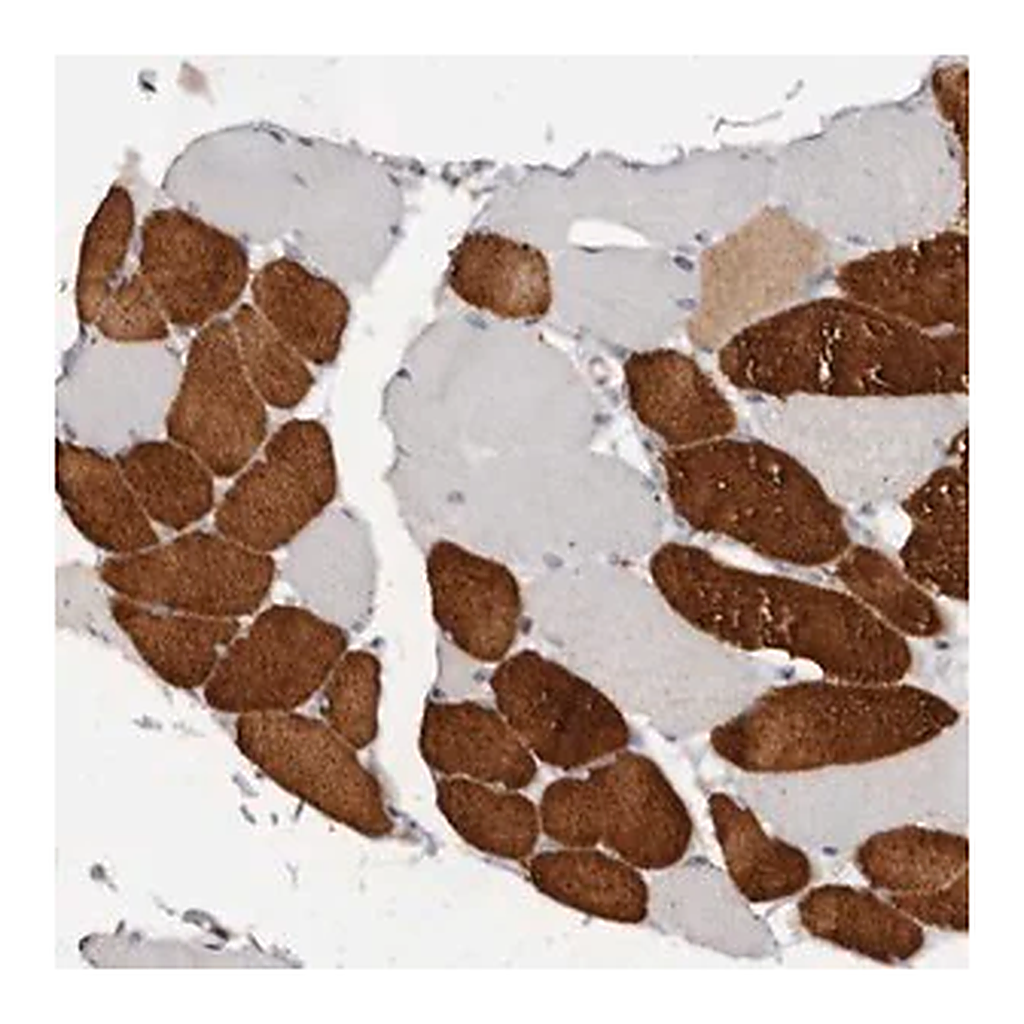 Merck Anti-TNNI1 antibody produced in rabbit
