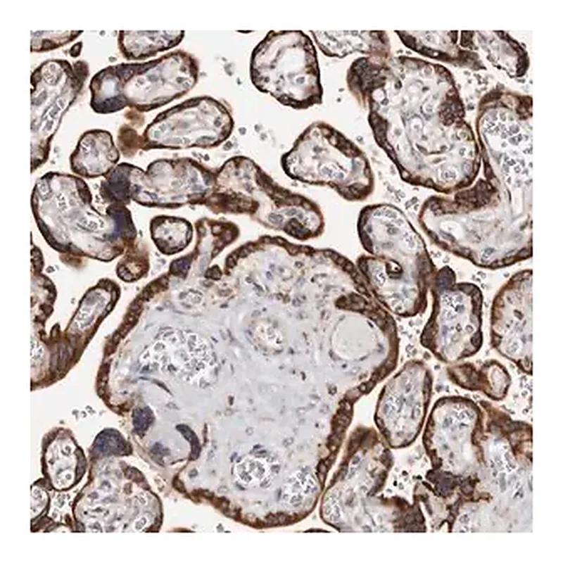 Merck Anti-ACBD6 antibody produced in rabbit