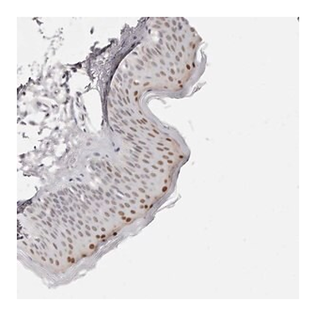 Merck Anti-CASZ1 antibody produced in rabbit