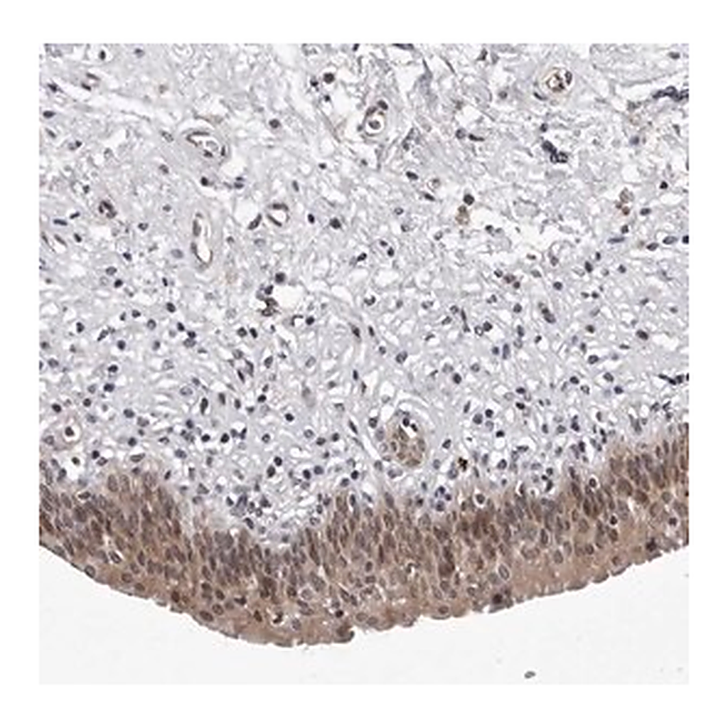Merck Anti-KIAA1614 antibody produced in rabbit