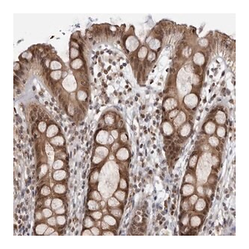 Merck Anti-RASGEF1C antibody produced in rabbit