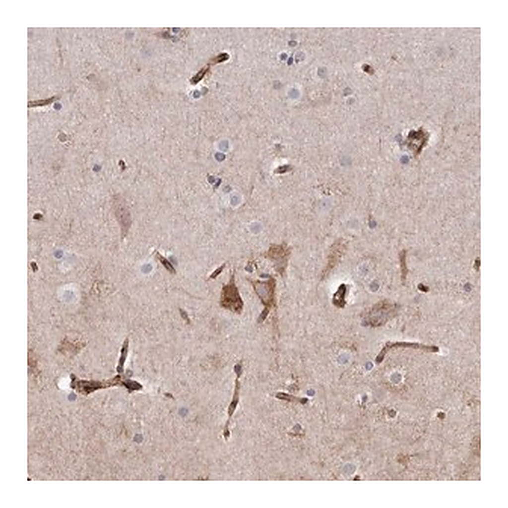 Merck Anti-SEMA3E antibody produced in rabbit