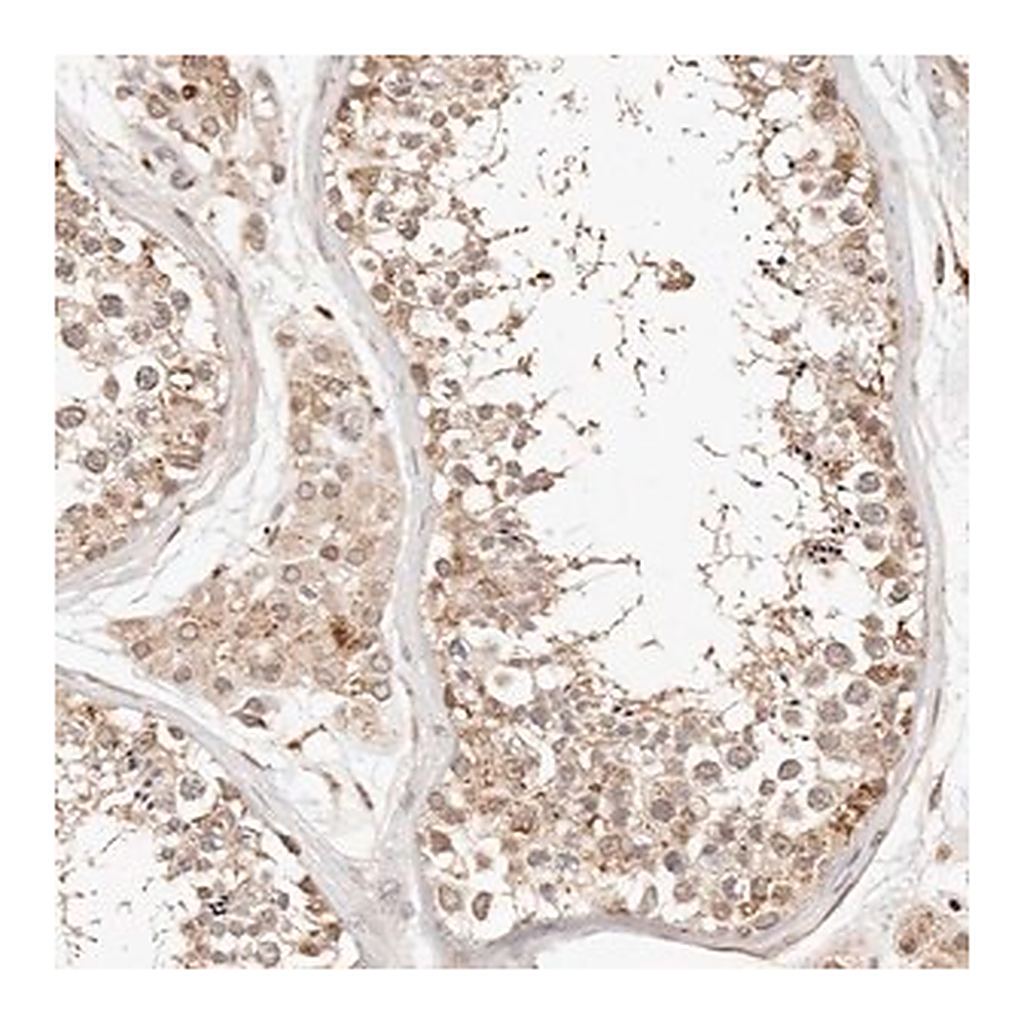 Merck Anti-KIF9 antibody produced in rabbit