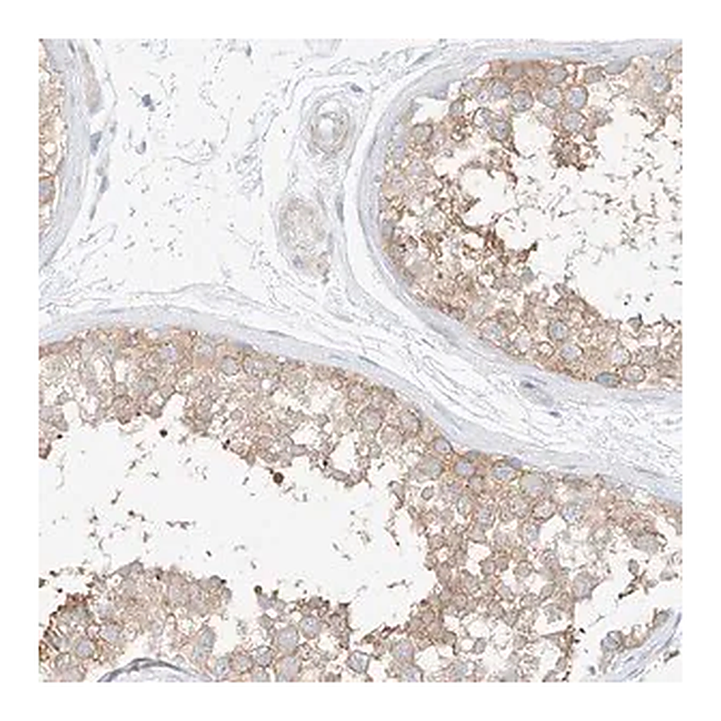 Merck Anti-PPP6R2 antibody produced in rabbit