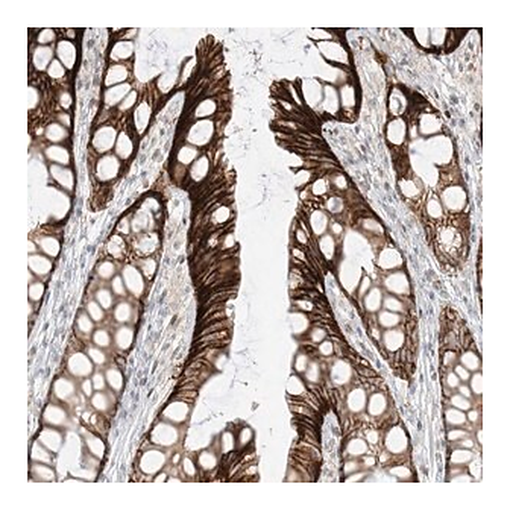 Merck Anti-ZNF774 antibody produced in rabbit