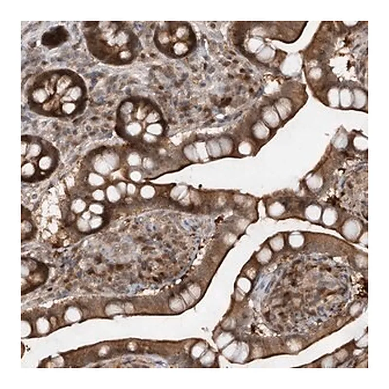 Merck Anti-ZNF358 antibody produced in rabbit