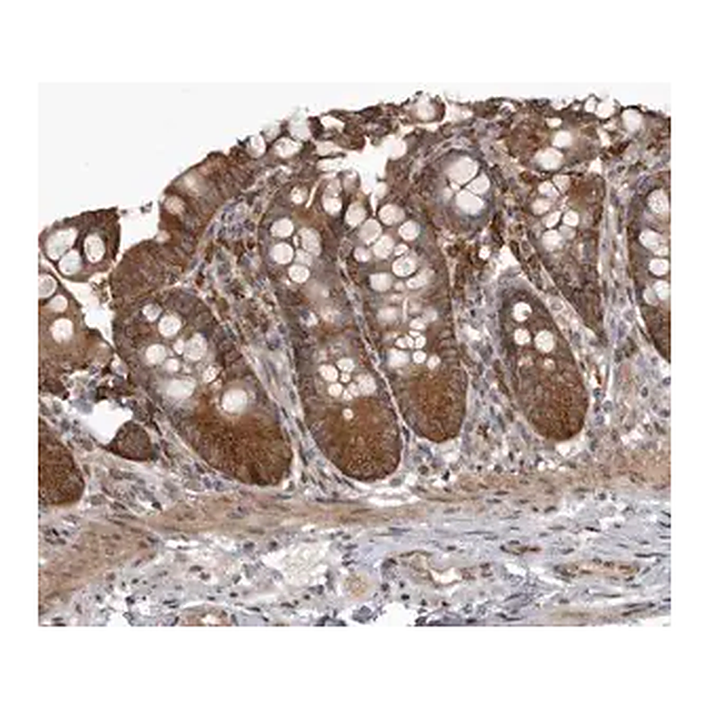 Merck Anti-SNX16 antibody produced in rabbit