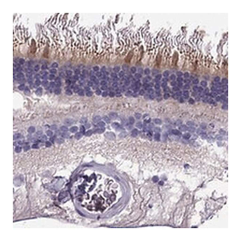 Merck Anti-KCNV2 antibody produced in rabbit