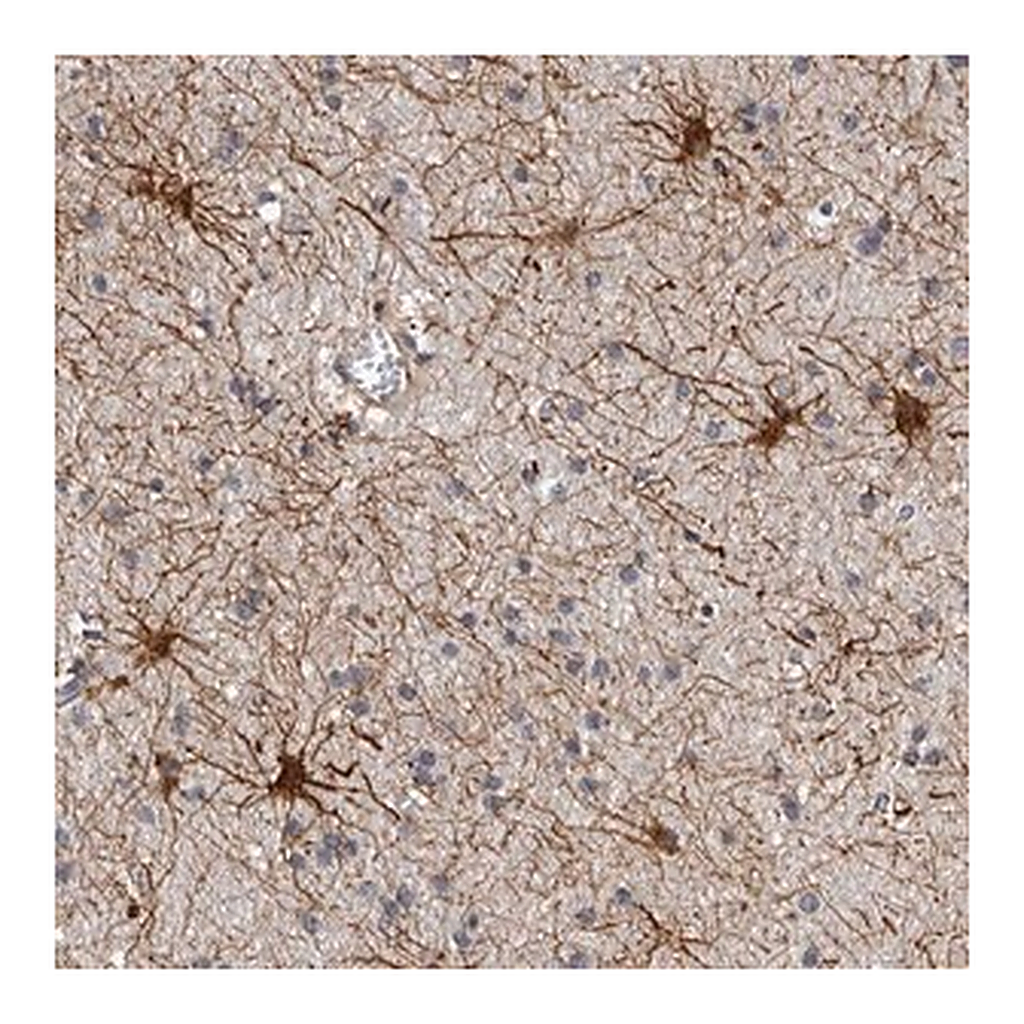 Merck Anti-ADCK5 antibody produced in rabbit