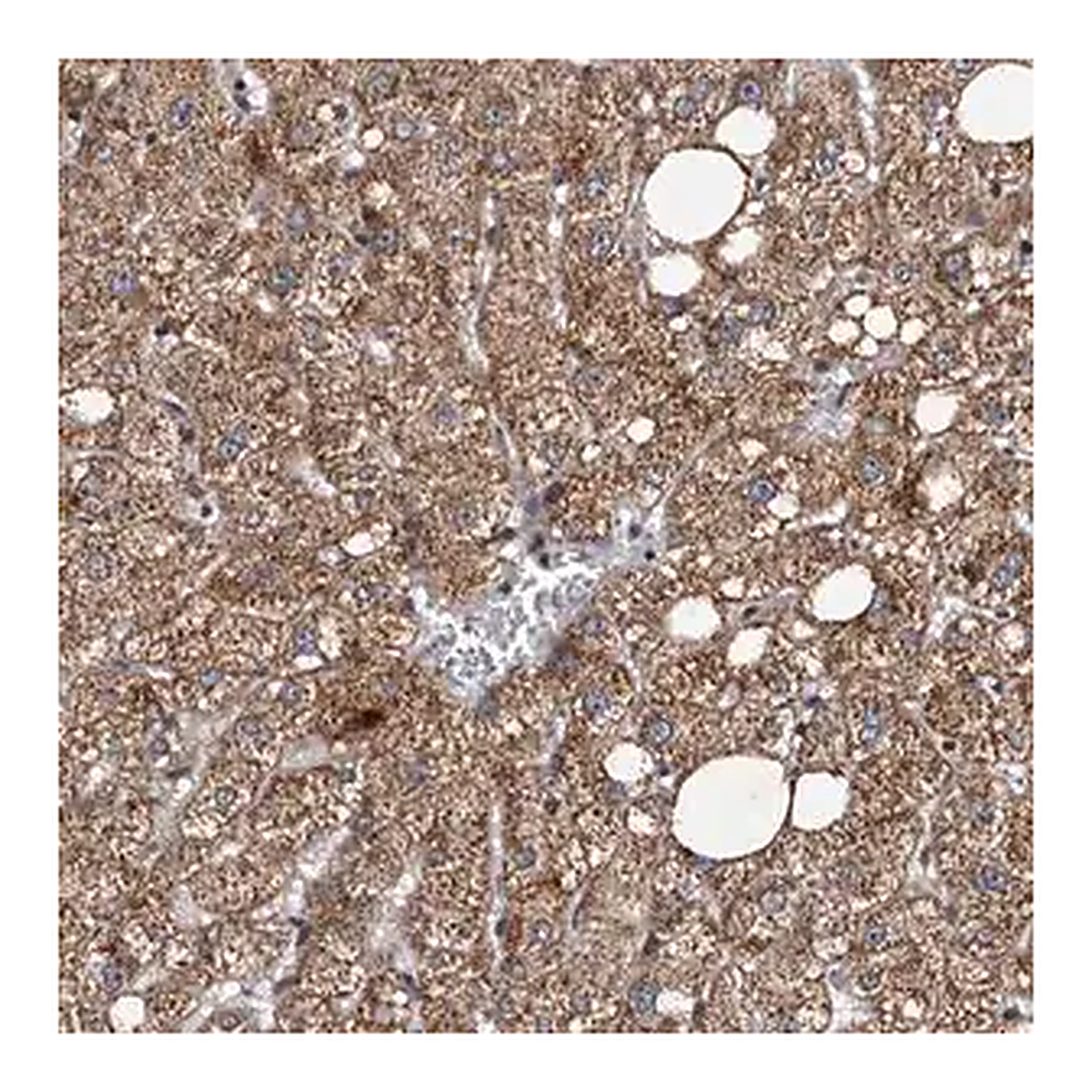 Merck Anti-TNKS antibody produced in rabbit
