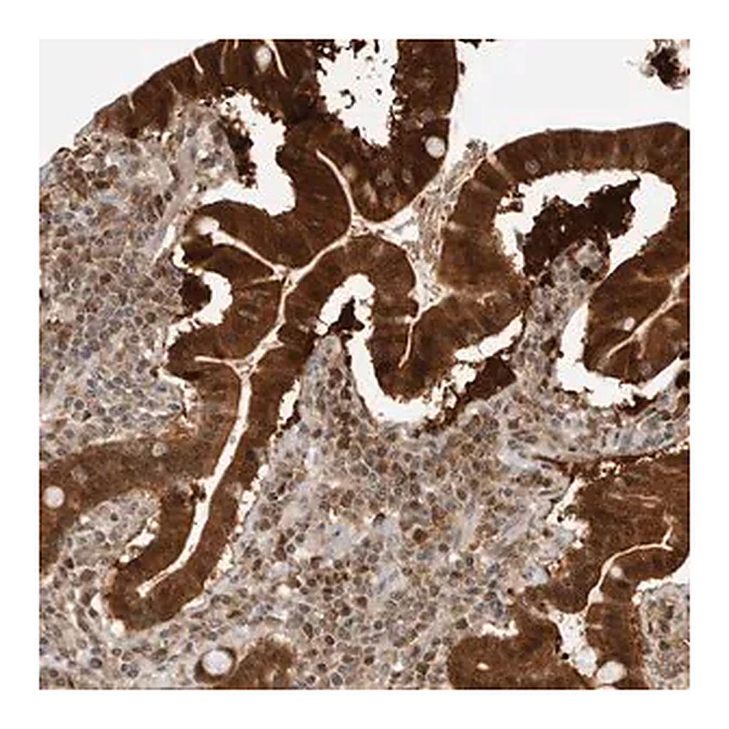 Merck Anti-BMP2K antibody produced in rabbit