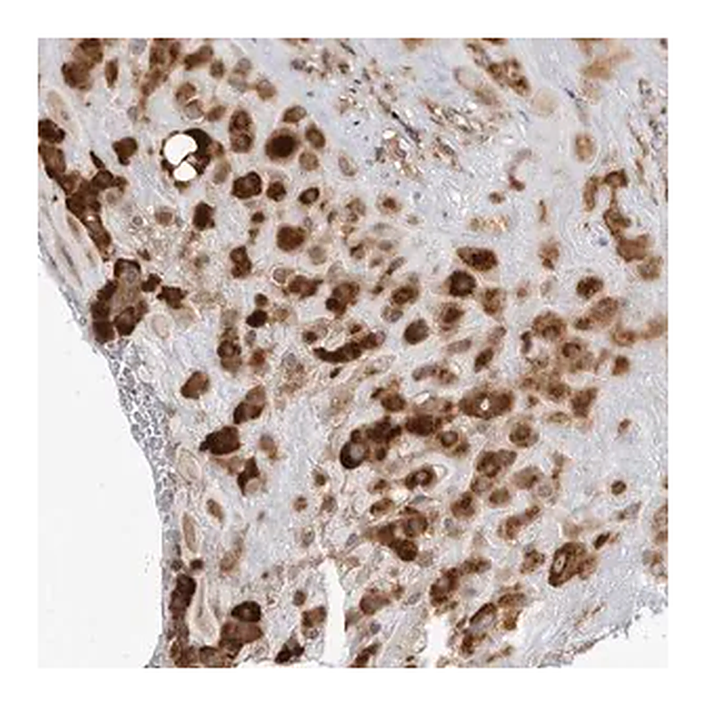 Merck Anti-BMP2K antibody produced in rabbit