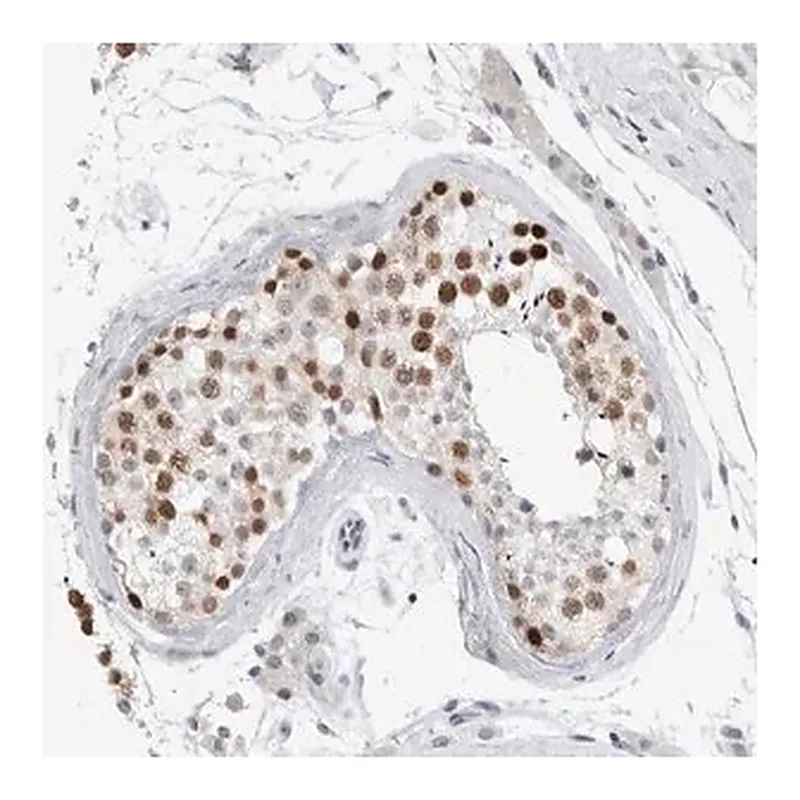 Merck Anti-KNL1 antibody produced in rabbit