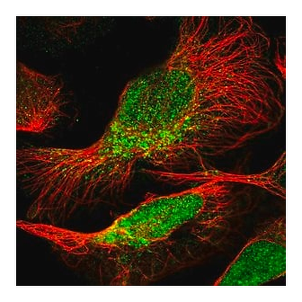 Merck Anti-PEA15 antibody produced in rabbit