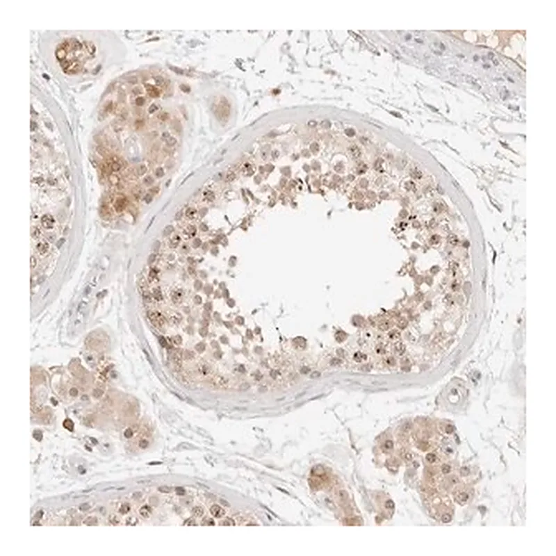 Merck Anti-C17orf47 antibody produced in rabbit