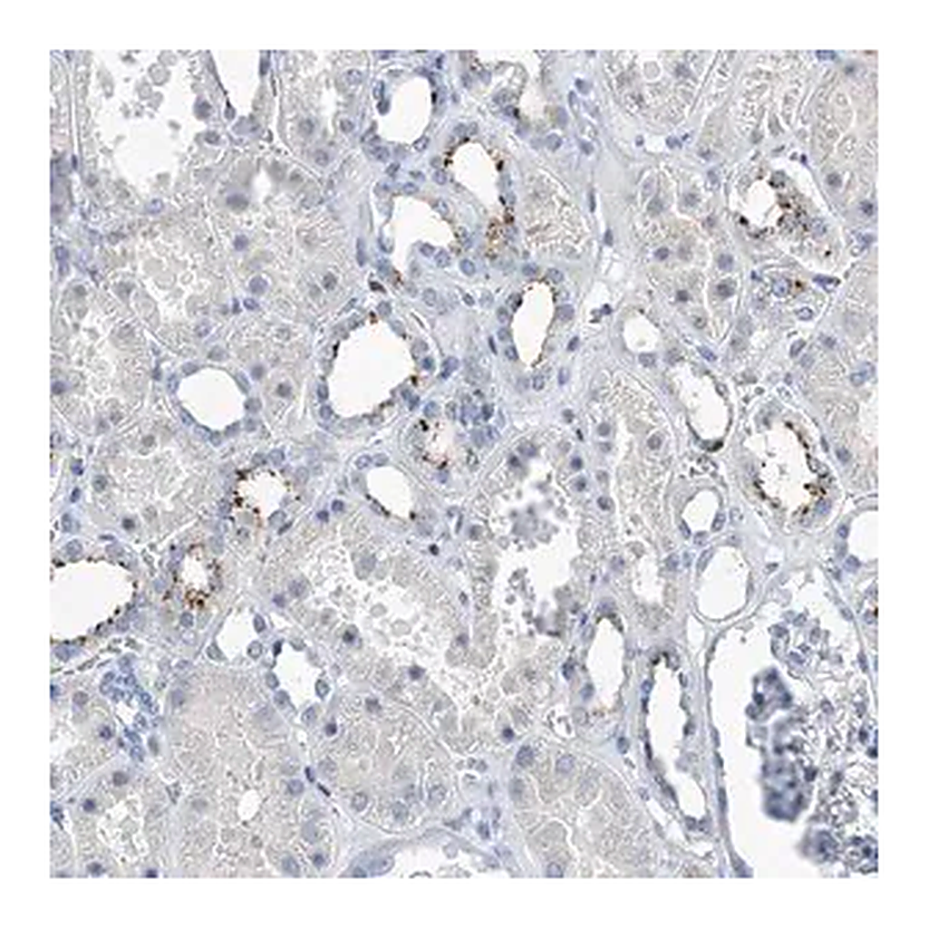Merck Anti-ZNF772 antibody produced in rabbit