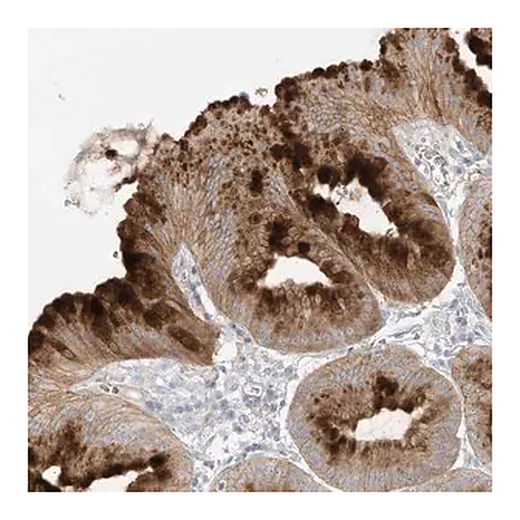 Merck Anti-DGKQ antibody produced in rabbit | 캐시바이