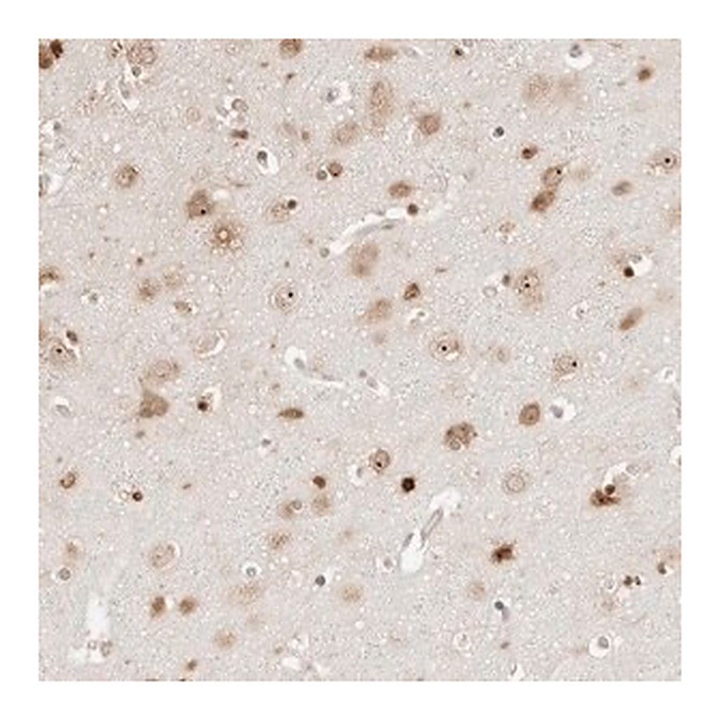 Merck Anti-FKBP14 antibody produced in rabbit