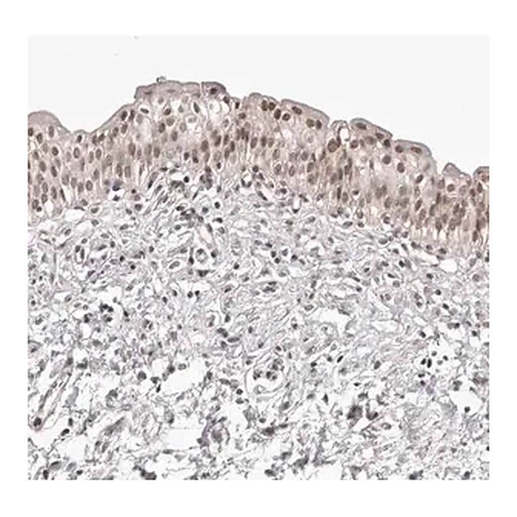 Merck Anti-RNF2 antibody produced in rabbit
