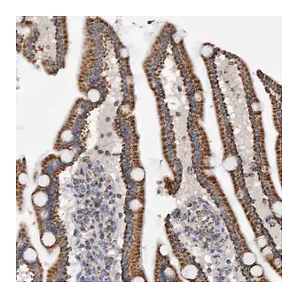 Merck Anti-WFDC1 antibody produced in rabbit