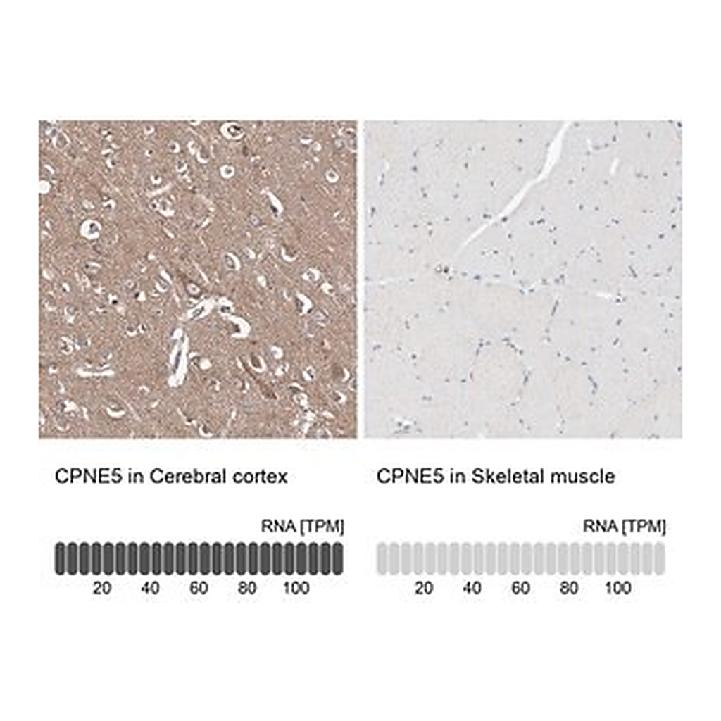 Merck Anti-CPNE5 antibody produced in rabbit