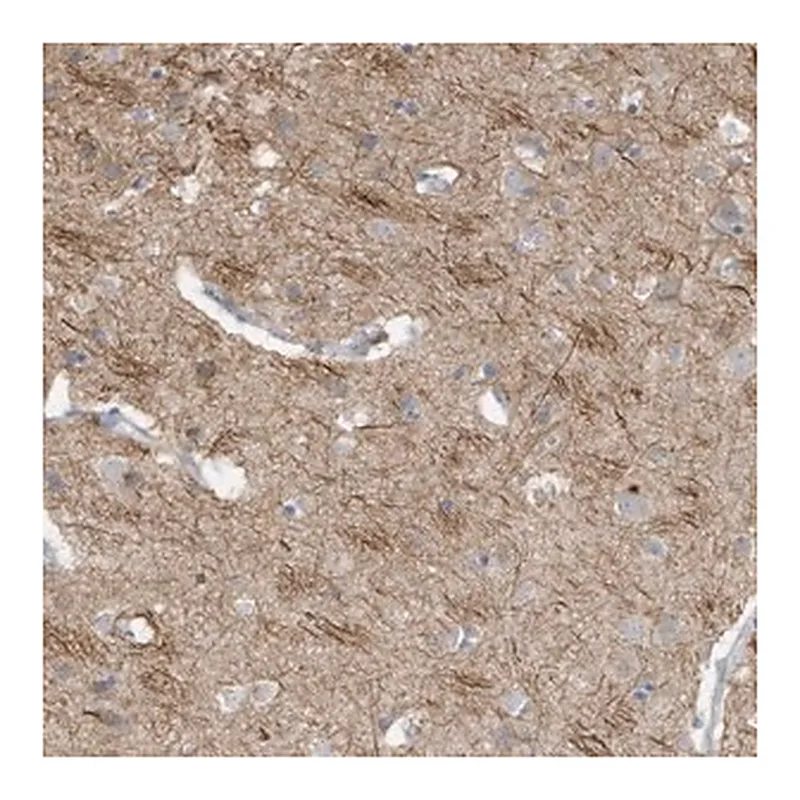 Merck Anti-GTPBP2 antibody produced in rabbit