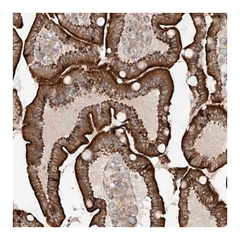 Merck Anti-MTUS2 antibody produced in rabbit