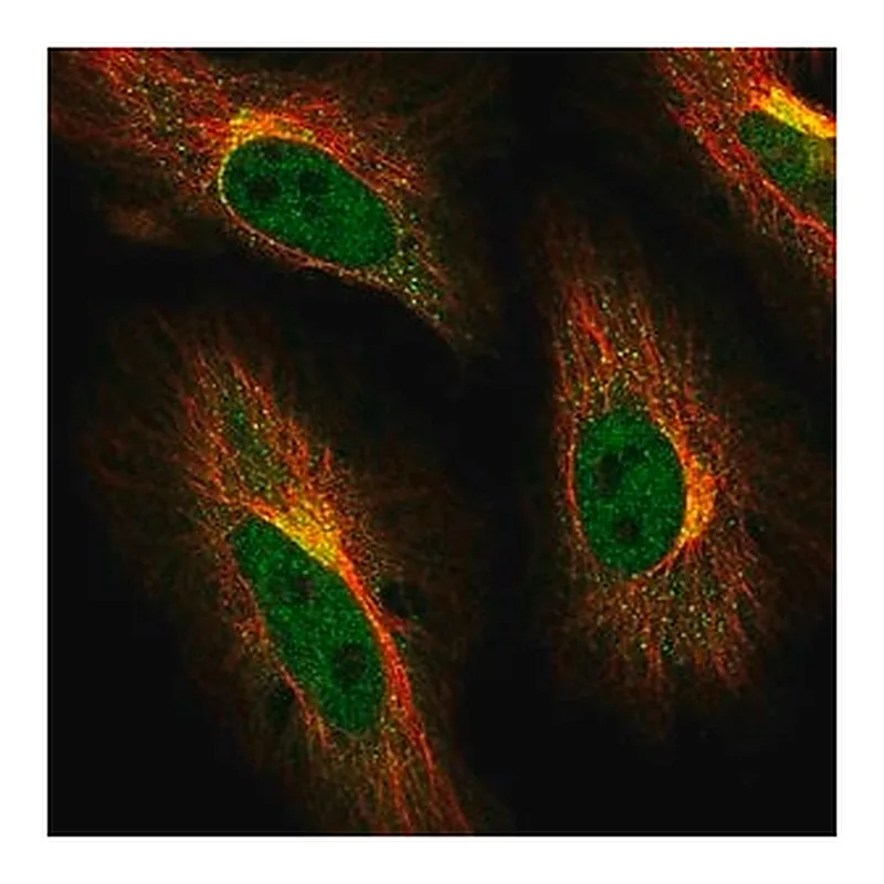 Merck Anti-ABCG1 antibody produced in rabbit