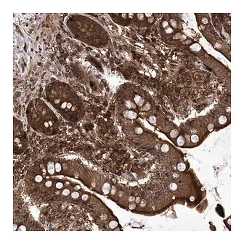 Merck Anti-MAGED2 antibody produced in rabbit