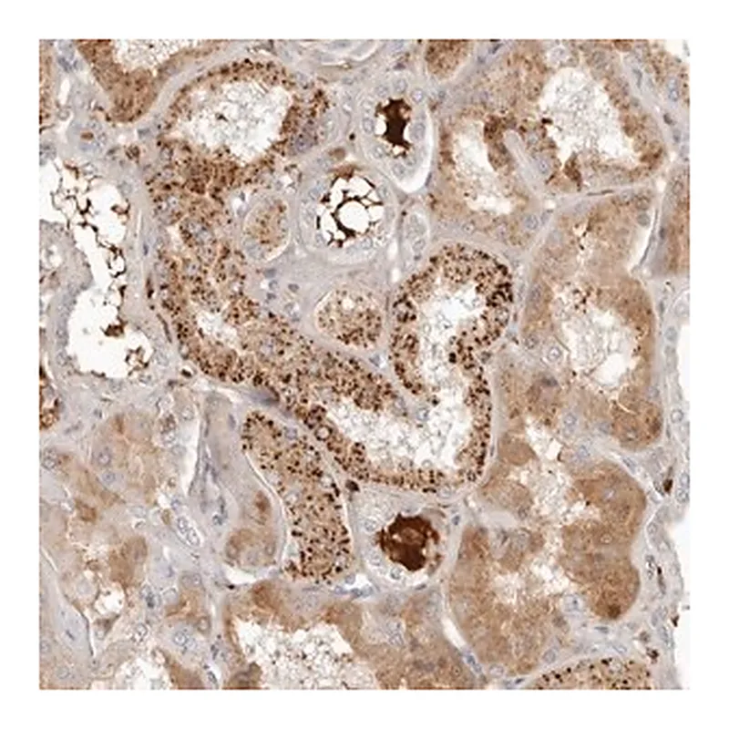 Merck Anti-KLHL38 antibody produced in rabbit