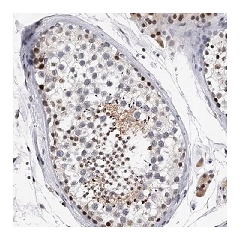 Merck Anti-TESK2 antibody produced in rabbit