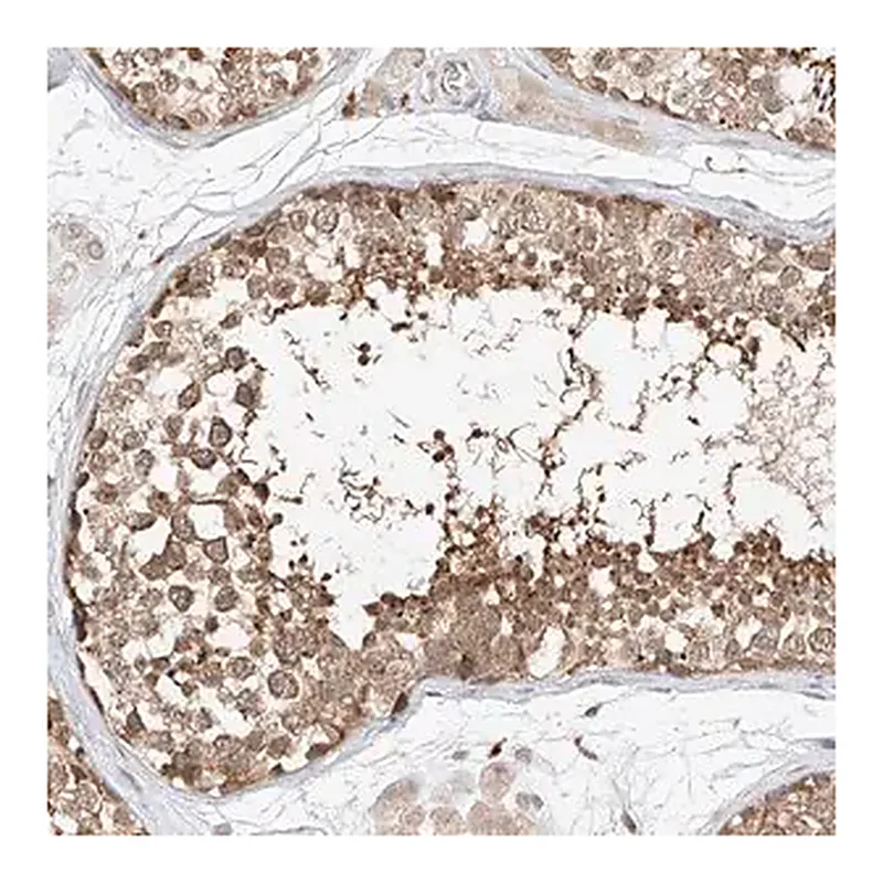 Merck Anti-DIRAS3 antibody produced in rabbit