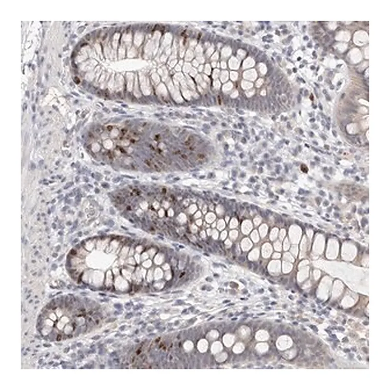 Merck Anti-CCDC190 antibody produced in rabbit