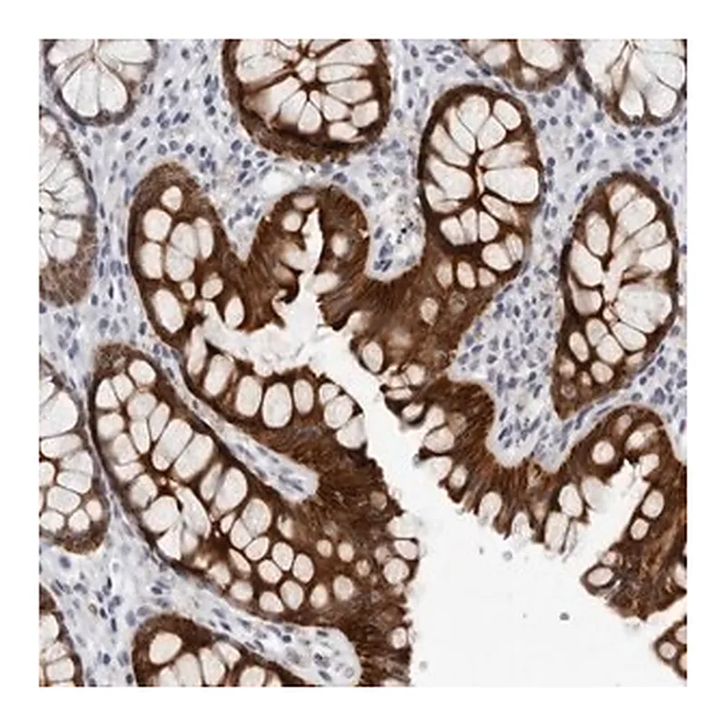 Merck Anti-CCDC28B antibody produced in rabbit