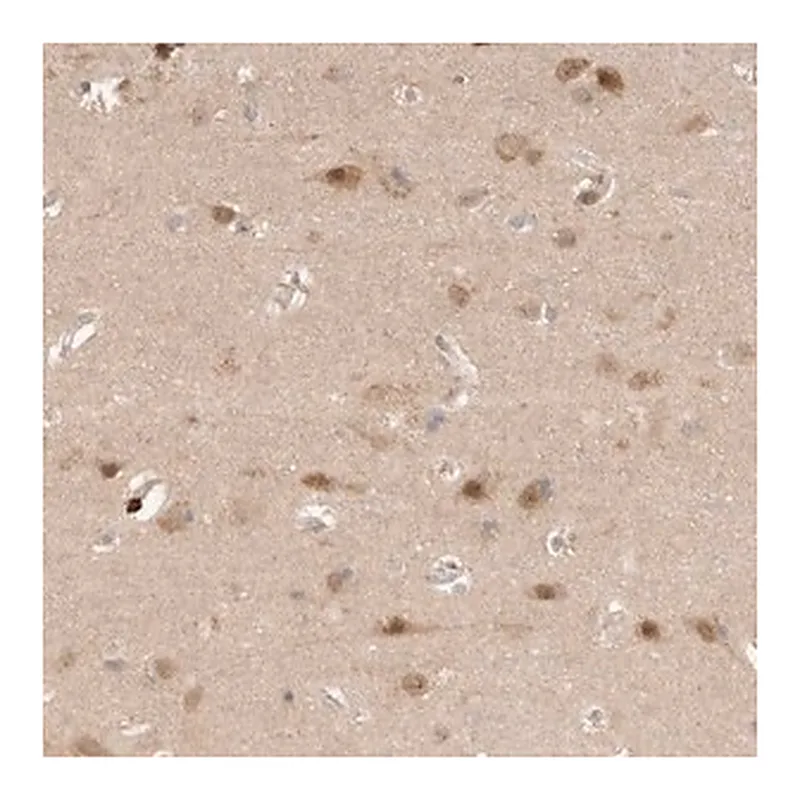 Merck Anti-AHDC1 antibody produced in rabbit