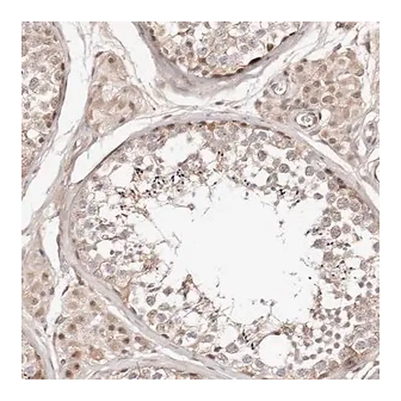 Merck Anti-WRN antibody produced in rabbit