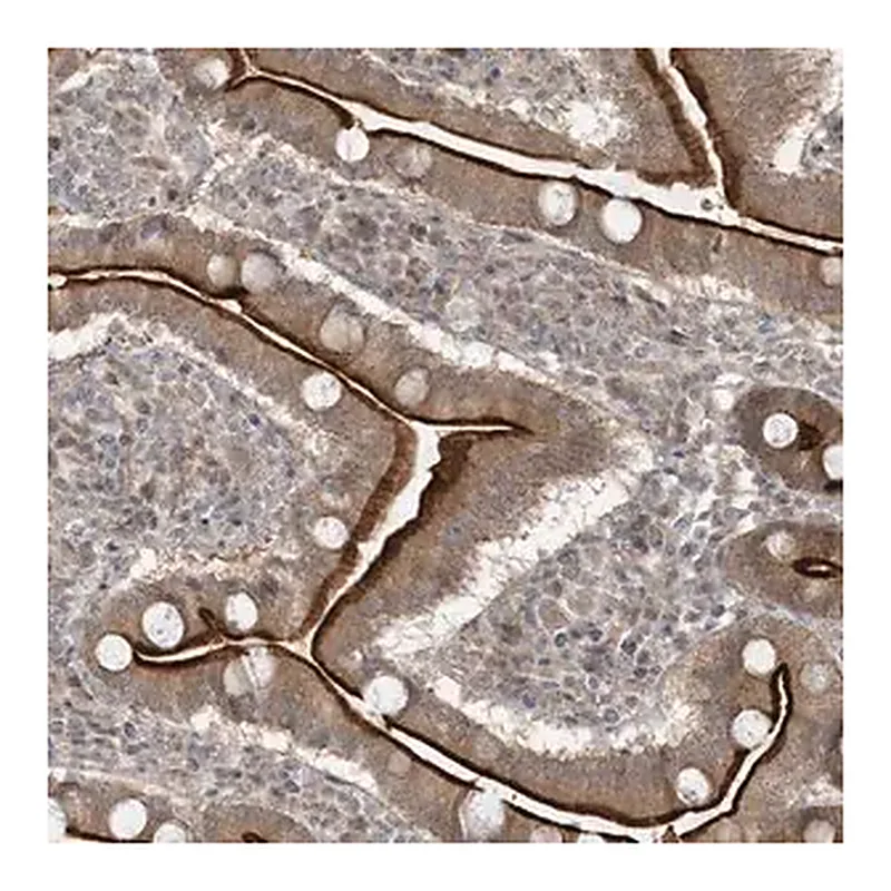 Merck Anti-BCORL1 antibody produced in rabbit