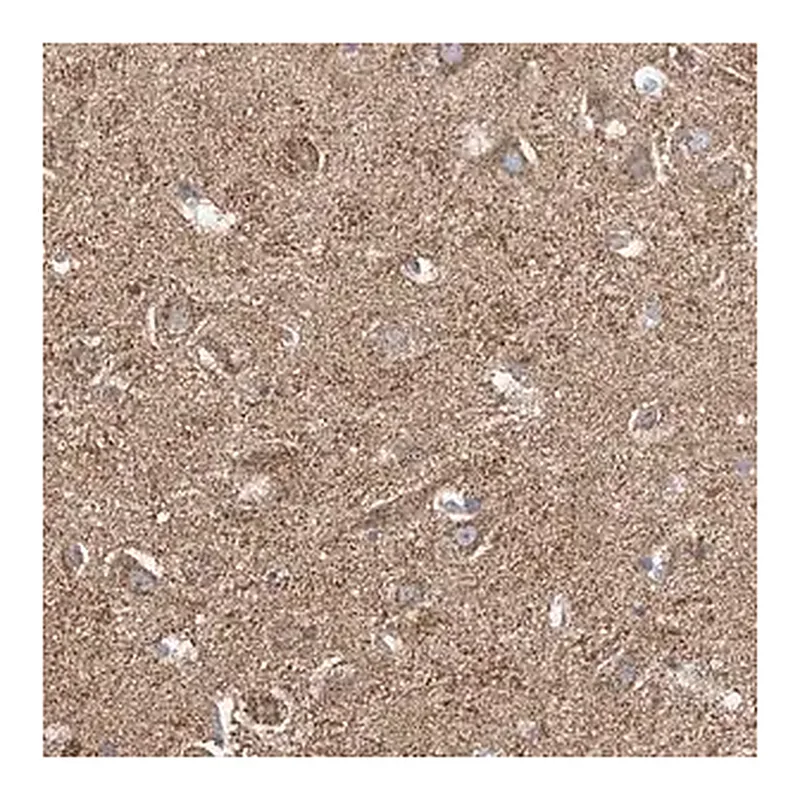 Merck Anti-NALCN antibody produced in rabbit