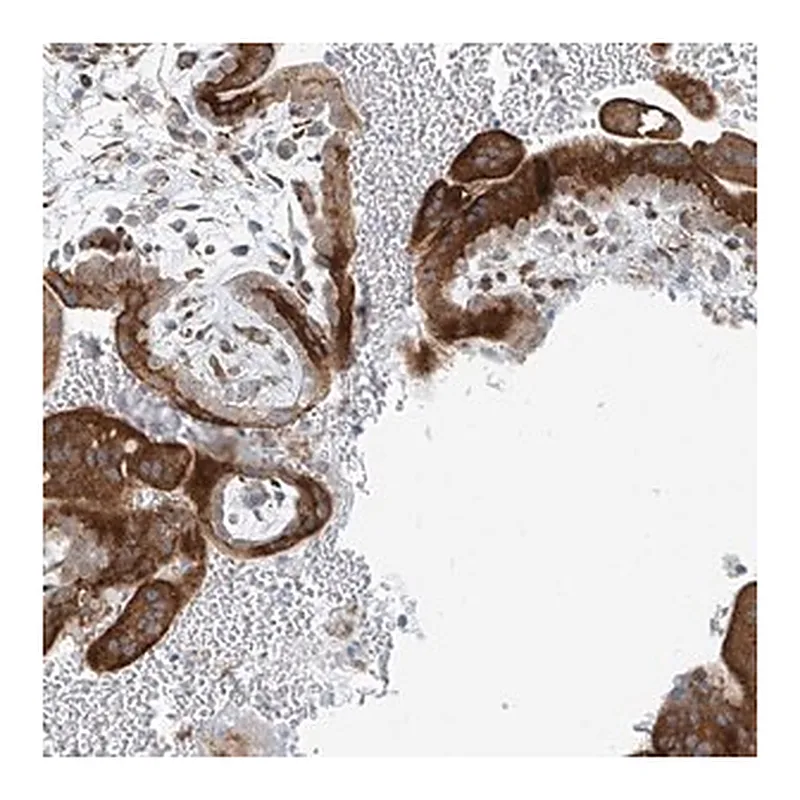 Merck Anti-HIC2 antibody produced in rabbit