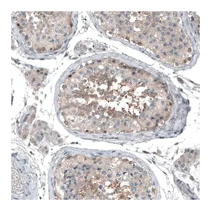 Merck Anti-ABCC11 antibody produced in rabbit