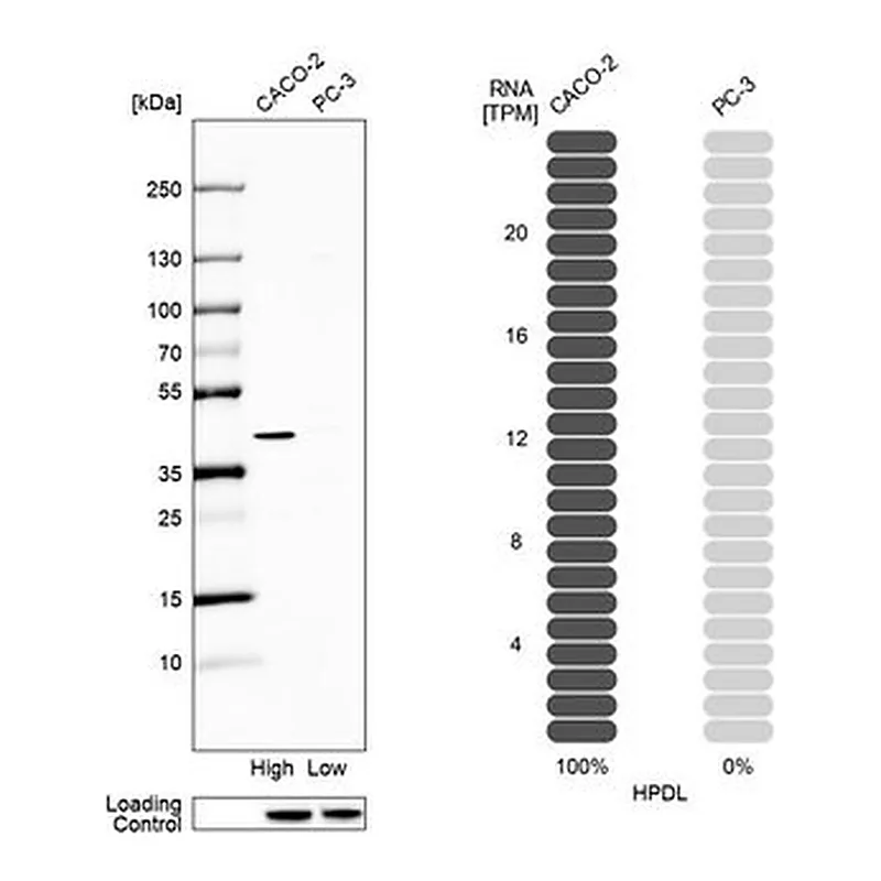 Merck Anti-HPDL antibody produced in rabbit