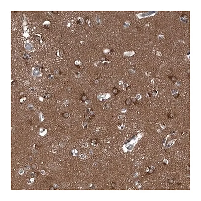 Merck Anti-GAK antibody produced in rabbit