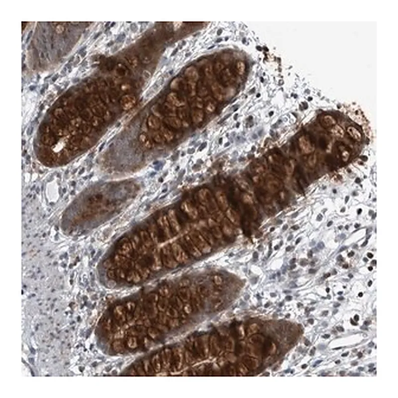 Merck Anti-GAK antibody produced in rabbit