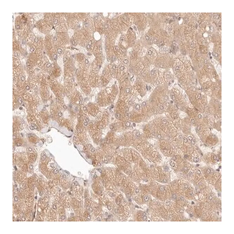 Merck Anti-PPP1R3B antibody produced in rabbit