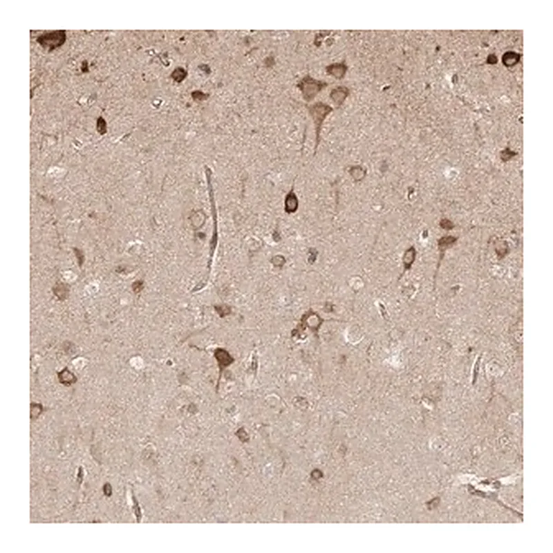 Merck Anti-UBE2K antibody produced in rabbit