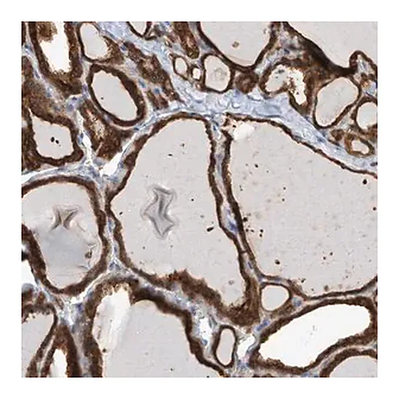 Merck Anti-OR4K1 antibody produced in rabbit