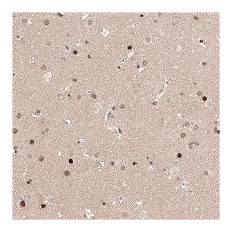Merck Anti-HDAC9 antibody produced in rabbit