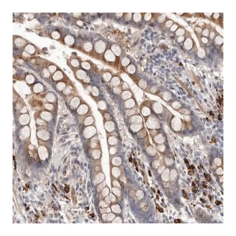 Merck Anti-ATXN3L antibody produced in rabbit